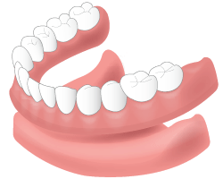 denture-01