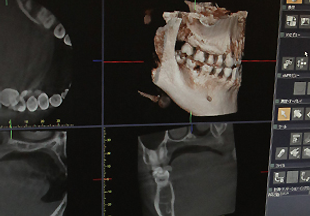 歯科用CT完備のイメージ