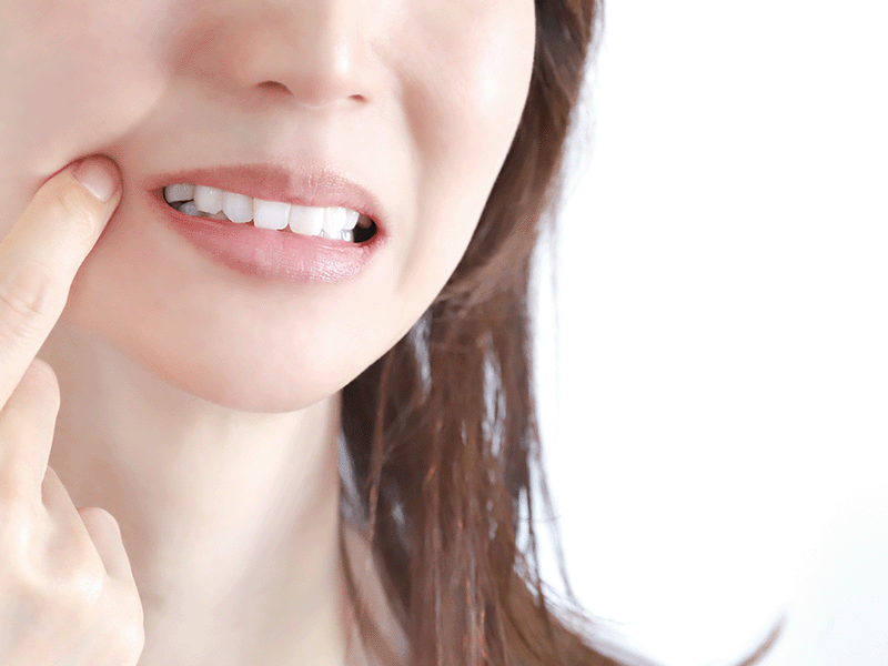 歯が気にある女性