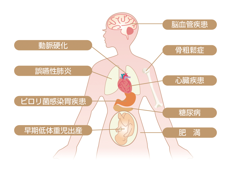 歯周病と全身疾患との関わり
