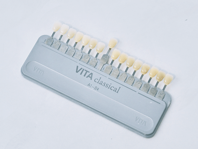 シェードガイド